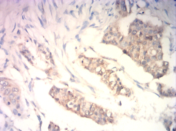 MEF2C Antibody