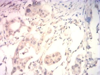 EMD Antibody