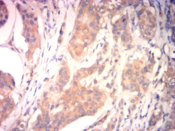 SLC2A4 Antibody