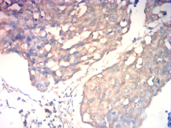 SLC2A4 Antibody