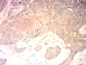 SLC2A4 Antibody