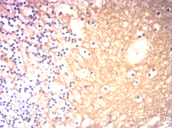 NTRK1 Antibody