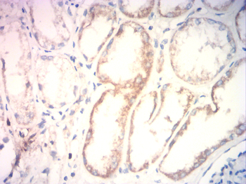 NTRK1 Antibody
