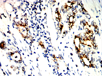 NTRK1 Antibody