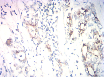 NTRK1 Antibody