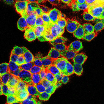 RAB10 Antibody