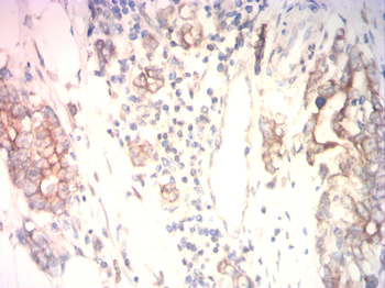 KRT5 Antibody