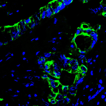 KRT5 Antibody