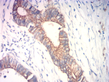 KRT5 Antibody