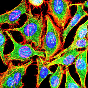 GPX4 Antibody