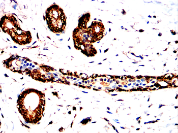 SDC1 Antibody
