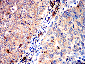 SDC1 Antibody