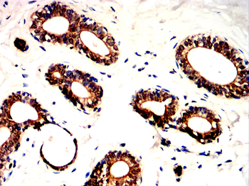 BMPR2 Antibody