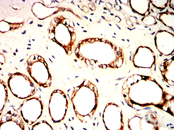BMPR2 Antibody