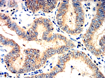 BMPR2 Antibody