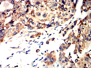 ACP5 Antibody