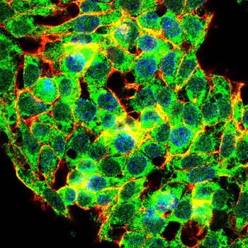 CD69 Antibody