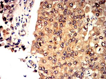 SETDB1 Antibody
