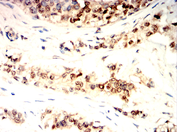 SETDB1 Antibody