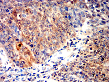 SETDB1 Antibody