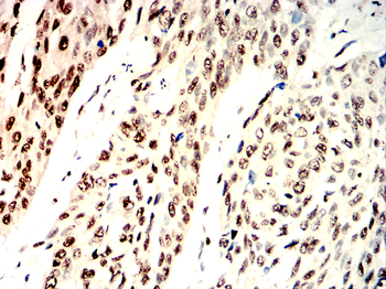 SETDB1 Antibody