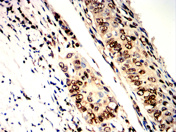 SETDB1 Antibody