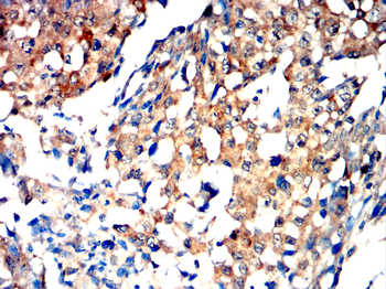DDR2 Antibody