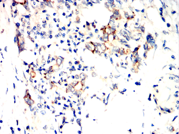DDR2 Antibody