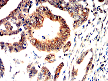 DDR2 Antibody