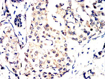 NME1 Antibody