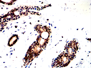 NME1 Antibody