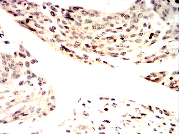 NME1 Antibody