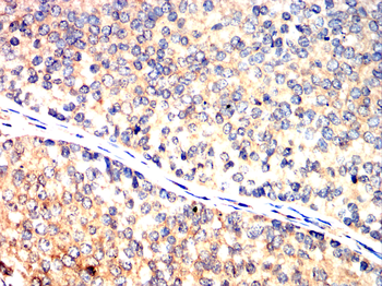 NME1 Antibody