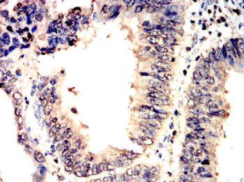 NME1 Antibody