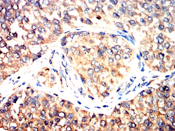 NME1 Antibody