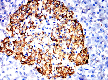 INS Antibody