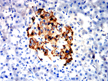 INS Antibody