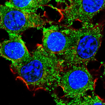 TNFSF11 Antibody