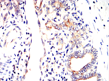 TNFSF11 Antibody