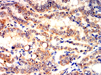 TNFSF11 Antibody