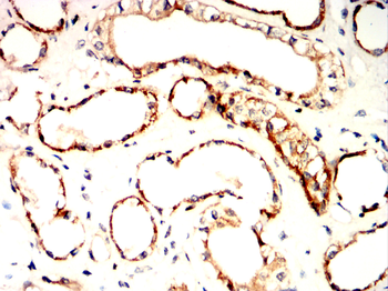 ALDH2 Antibody