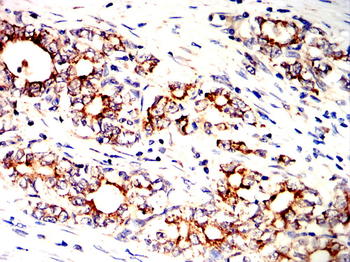 ALDH2 Antibody