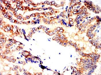 ALDH2 Antibody