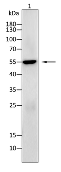 ALDH2 Antibody