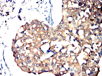 PIEZO1 Antibody