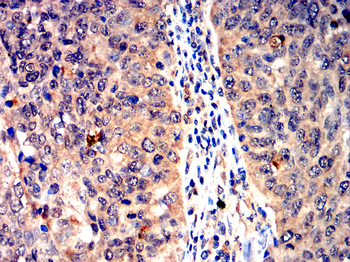 PIEZO1 Antibody