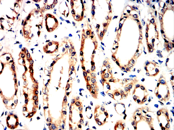 PIEZO1 Antibody