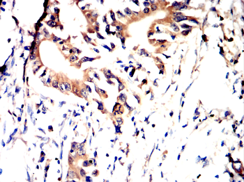 PIEZO1 Antibody