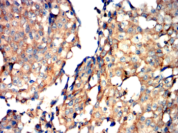 PCSK9 Antibody