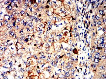 PCSK9 Antibody